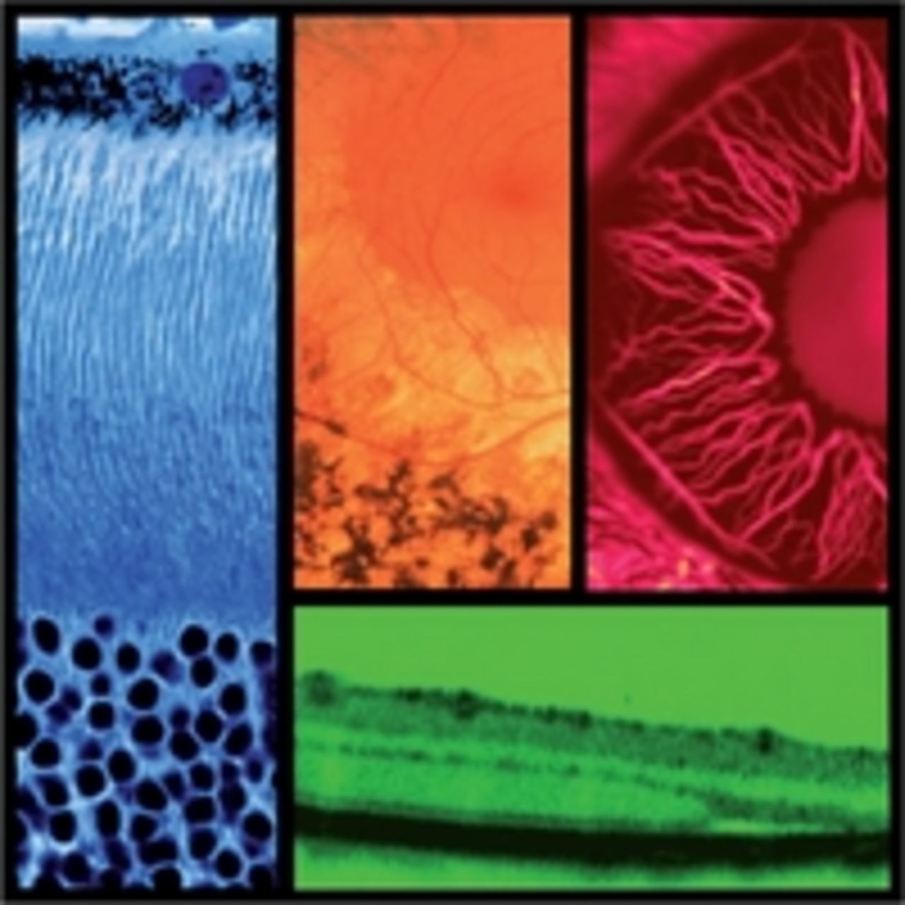 Different electron microscope images of the eye.