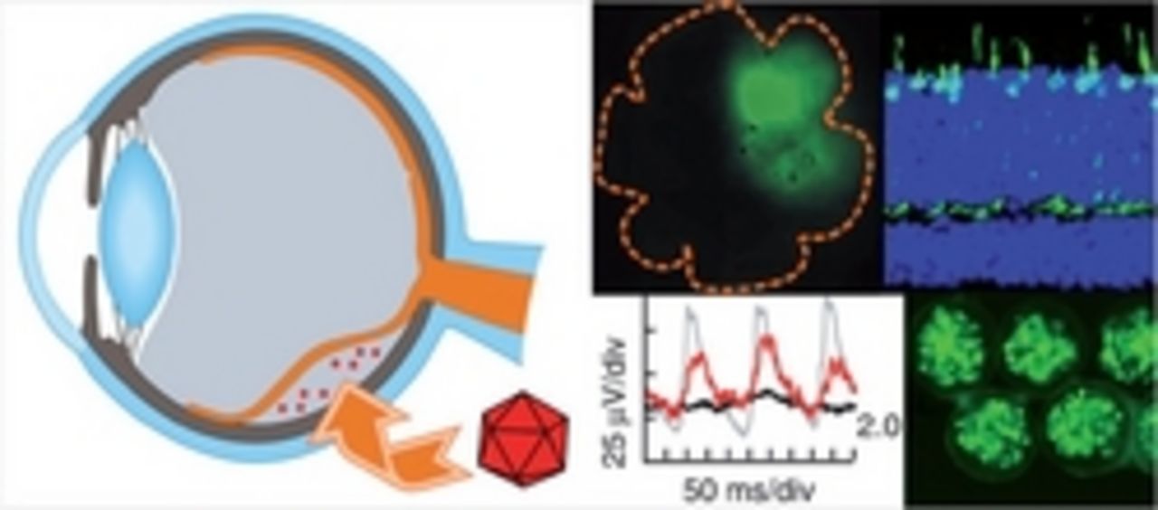 Schematic showing an eyeball, action potentials and electron microscope images.