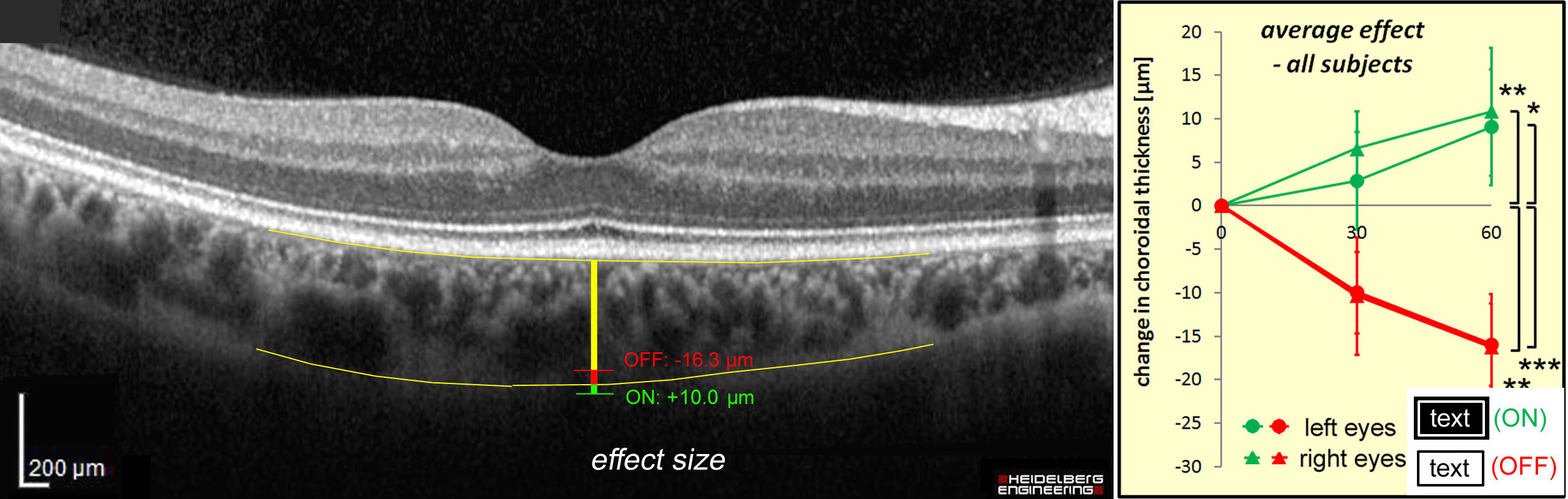 Figure 2 - Scientific Reports: Why might reading make myopic?